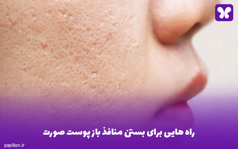 راه‌ هایی برای بستن منافذ باز پوست صورت