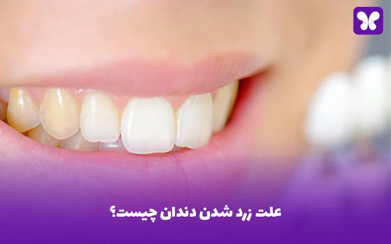 علت زرد شدن دندان چیست؟