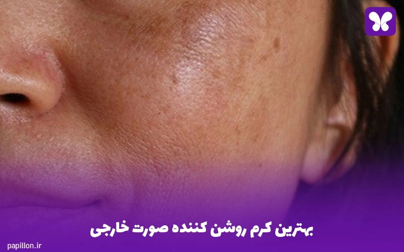 بهترین کرم روشن کننده صورت خارجی