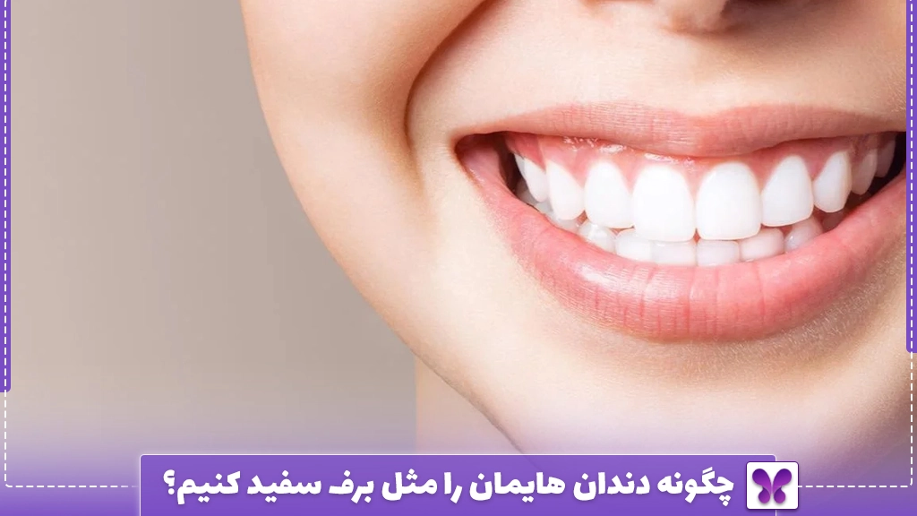 چگونه دندان هایمان را مثل برف سفید کنیم؟