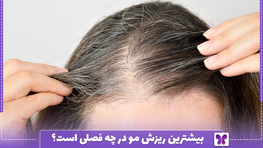 بیشترین ریزش مو در چه فصلی است؟