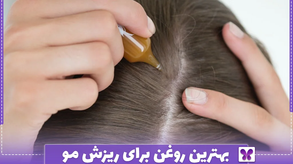 بهترین روغن برای ریزش مو