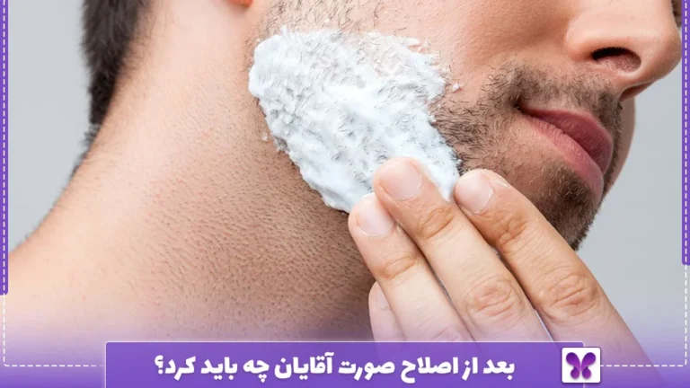 بعد از اصلاح صورت آقایان چه باید کرد؟