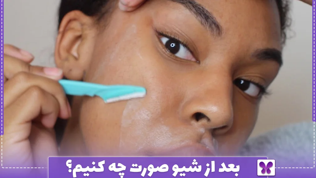 بعد از شیو صورت چه کنیم؟