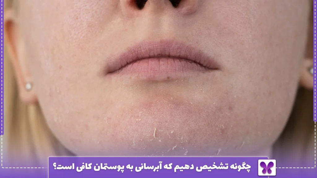 چگونه تشخیص دهیم که آبرسانی به پوستمان کافی است؟
