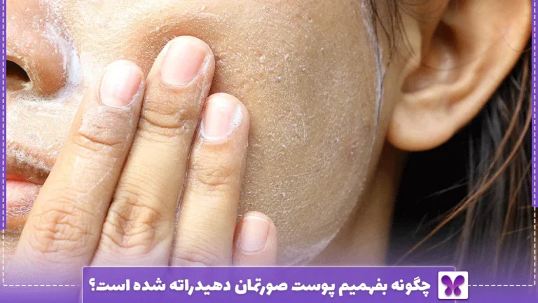 چگونه بفهمیم پوست صورتمان دهیدراته شده است؟