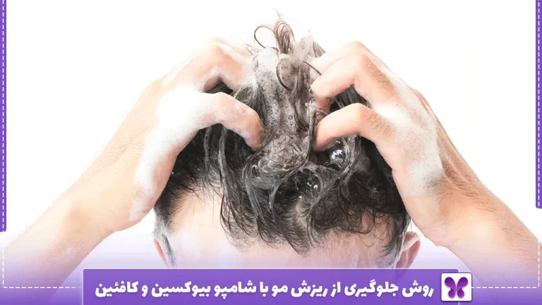روش جلوگیری از ریزش مو با شامپو بیوکسین و کافئین