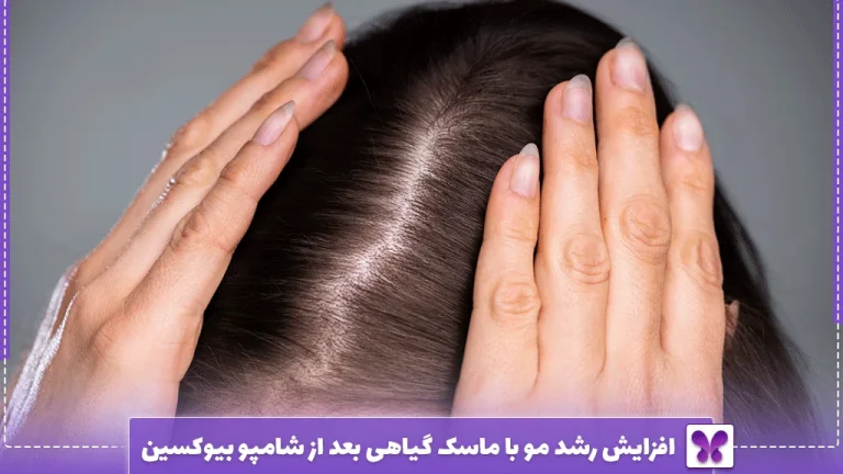 افزایش رشد مو با ماسک گیاهی بعد از شامپو بیوکسین
