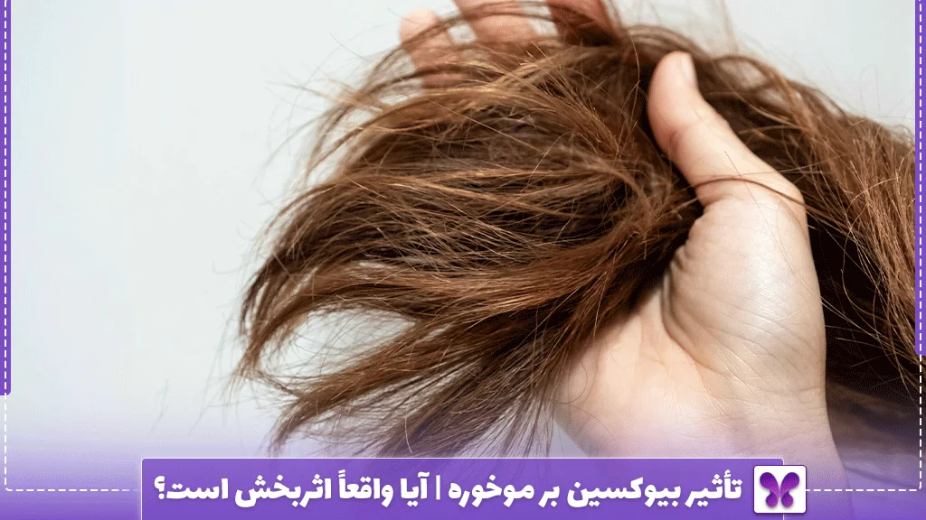 تأثیر بیوکسین بر موخوره | آیا واقعاً اثربخش است؟