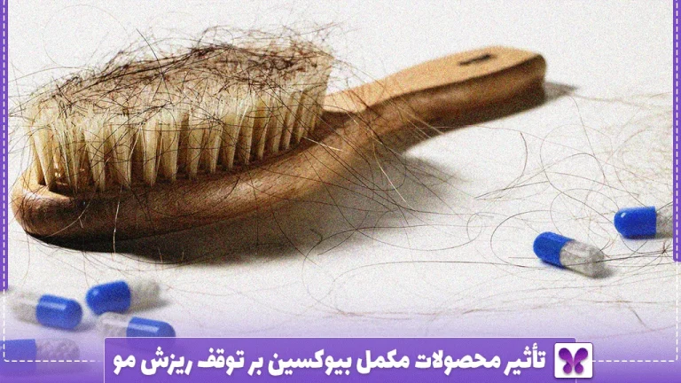 تأثیر محصولات مکمل بیوکسین بر توقف ریزش مو