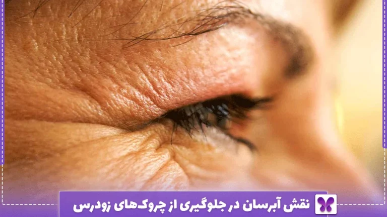 نقش آبرسان در جلوگیری از چروک‌های زودرس