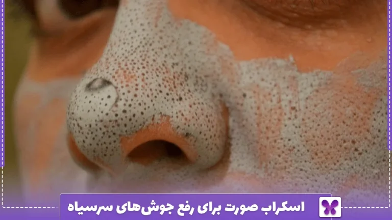 اسکراب صورت برای رفع جوش‌های سرسیاه