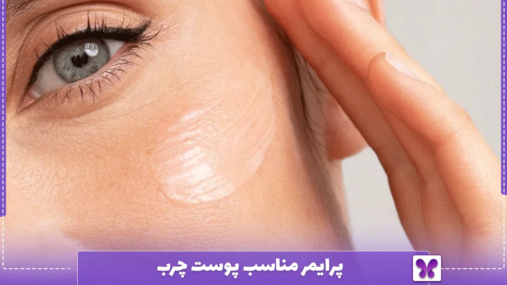 پرایمر مناسب پوست چرب