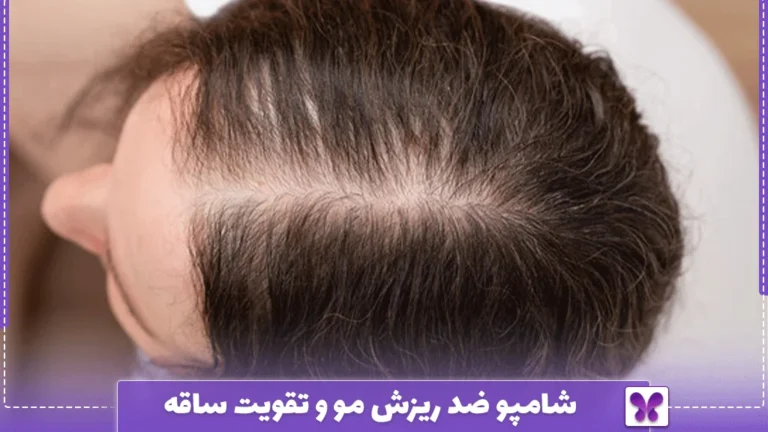 شامپو ضد ریزش مو و تقویت ساقه