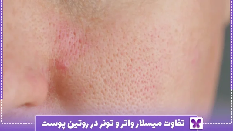 میسلار واتر برای پاک ‌سازی عمقی منافذ پوست