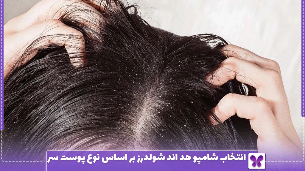 انتخاب شامپو هد اند شولدرز بر اساس نوع پوست سر