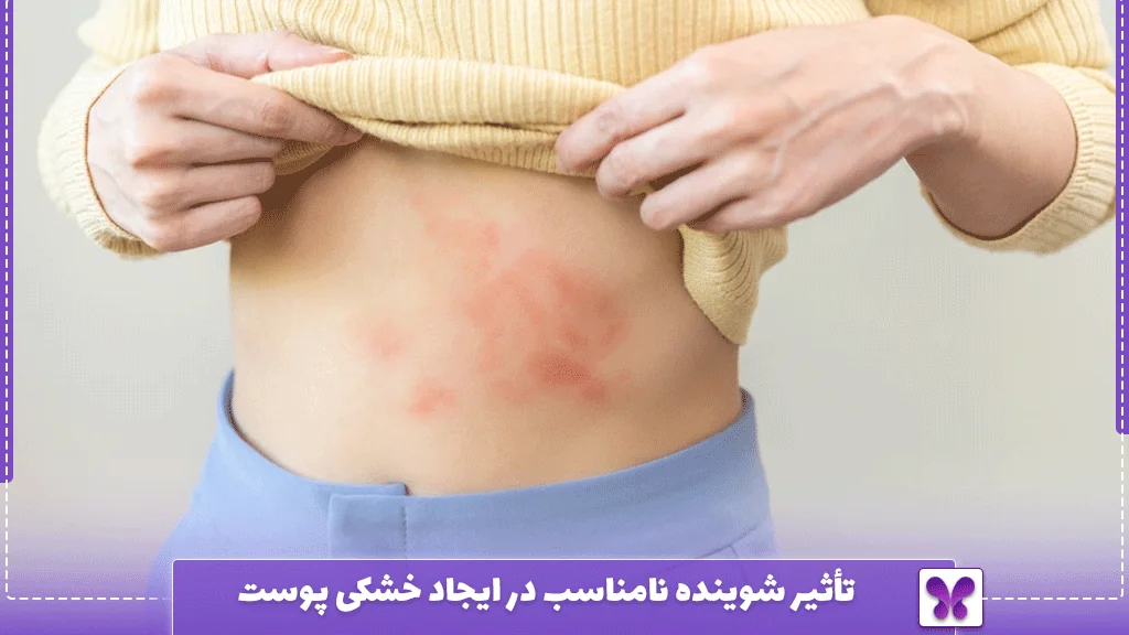 تأثیر شوینده نامناسب در ایجاد خشکی پوست 