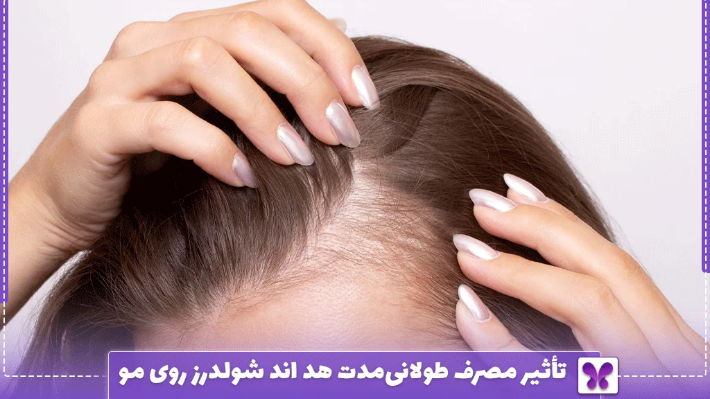 تأثیر مصرف طولانی‌مدت هد اند شولدرز روی مو