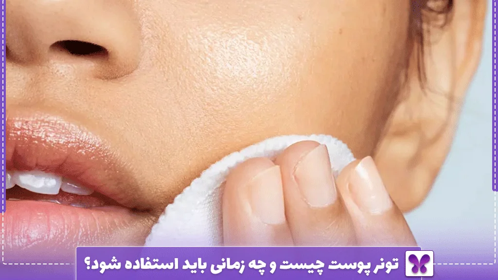 تونر پوست چیست و چه زمانی باید استفاده شود؟
