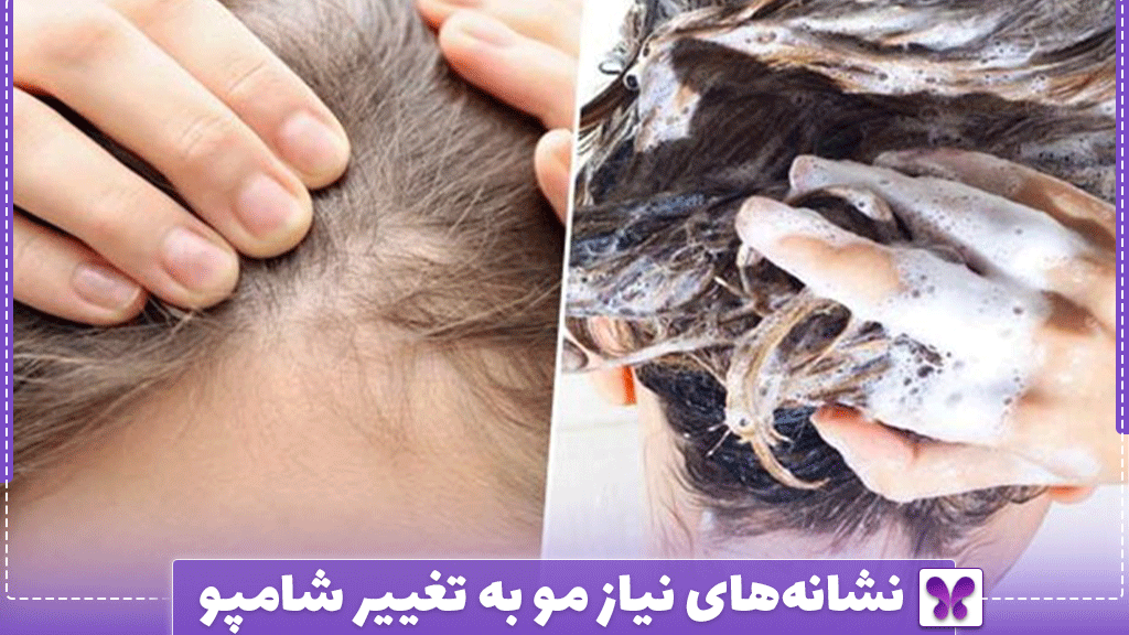 نشانه‌های نیاز مو به تغییر شامپو