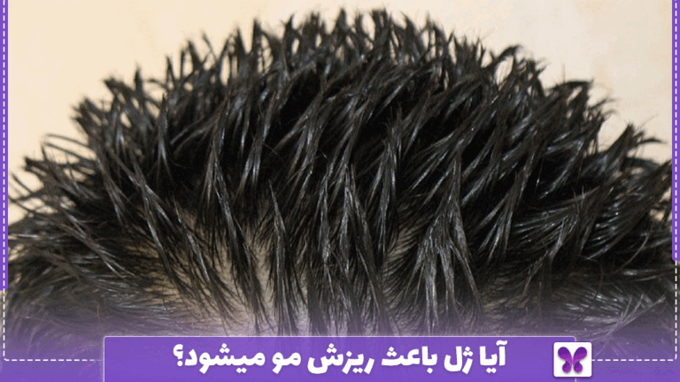 آیا ژل باعث ریزش مو میشود؟