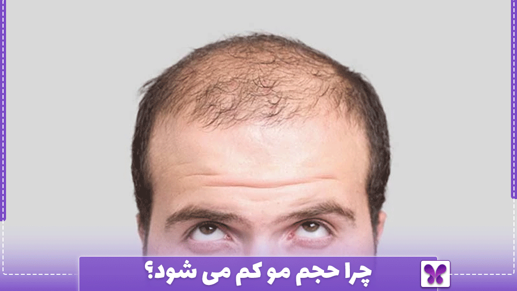 چرا حجم مو کم می شود؟