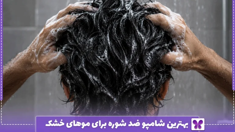بهترین شامپو ضد شوره برای موهای خشک