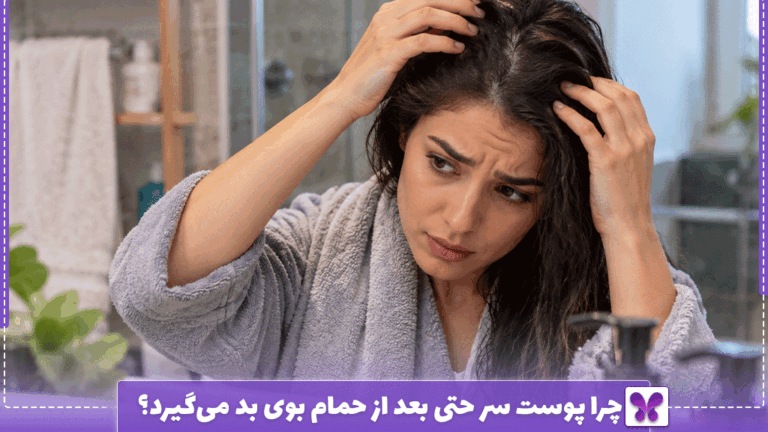 چرا پوست سر حتی بعد از حمام بوی بد می‌گیرد؟