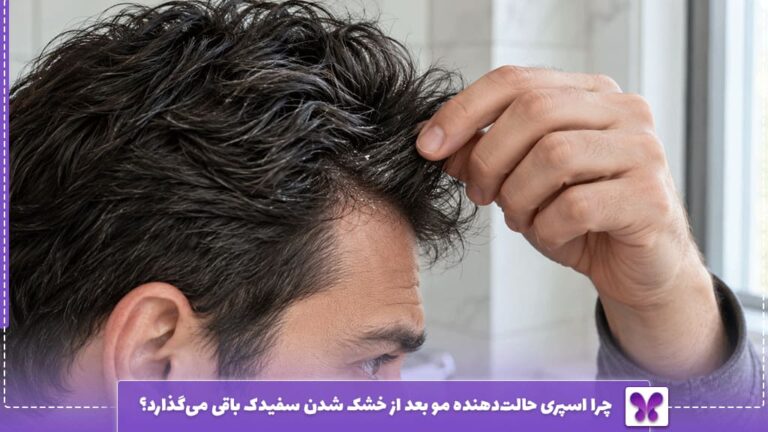 چرا اسپری حالت‌دهنده مو بعد از خشک شدن سفیدک باقی می‌گذارد؟